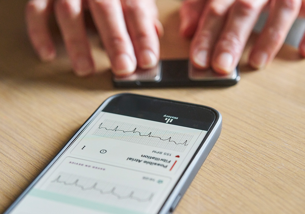 Redefining Atrial Fibrillation from YES or NO to what really matters